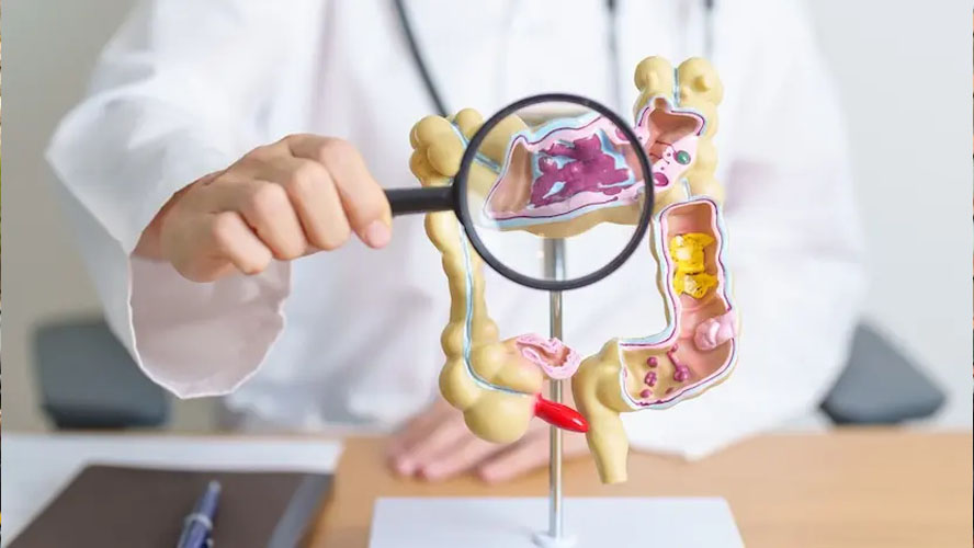ulcerative colitis drug