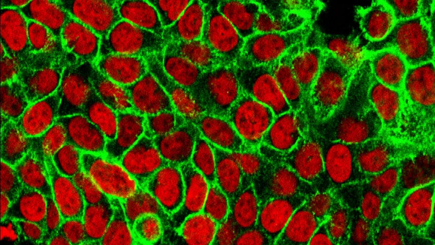 new blood test for colon cancer
