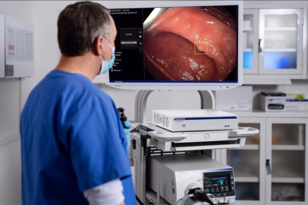 EAGLE Trial Shows Olympus® CADDIE™ AI Solution Aids in the Detection of High-Risk and Hard-to-Detect Colorectal Lesions (Olympus)